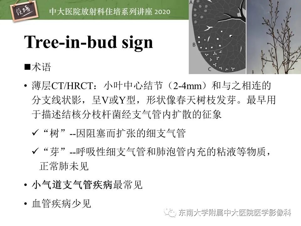 影像PPT - 【PPT】肺内常见影像征象解读 （树芽征、指套征）-3