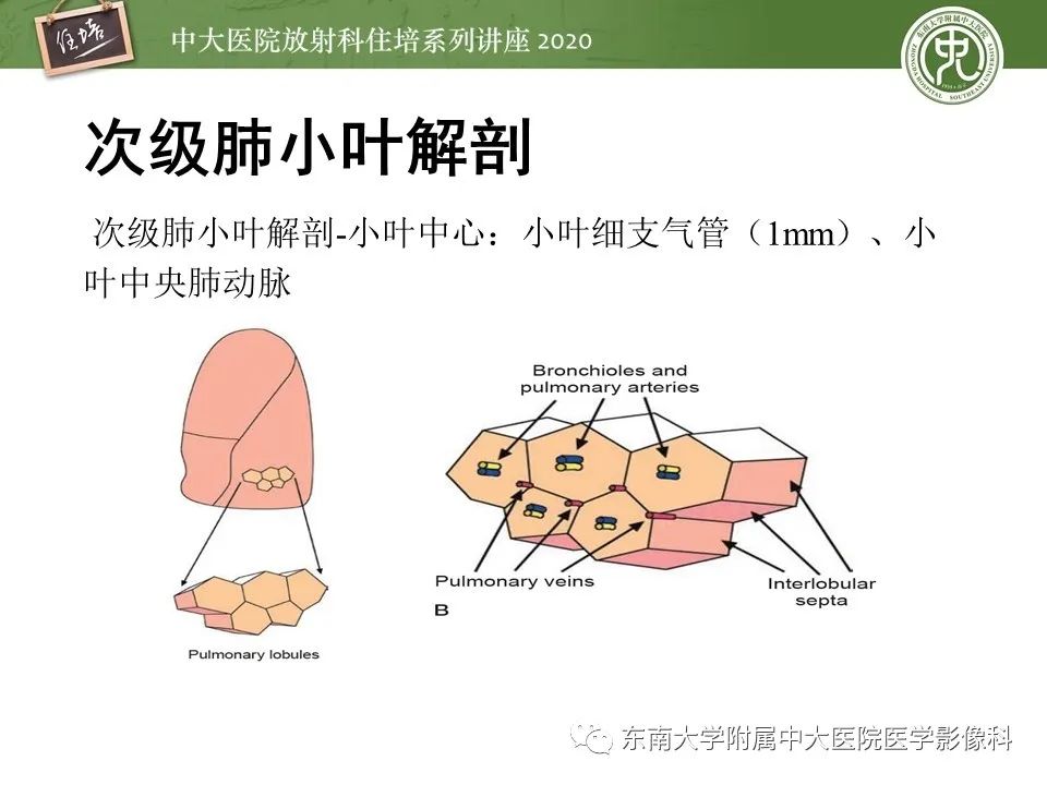 影像PPT - 【PPT】肺内常见影像征象解读 （树芽征、指套征）-5