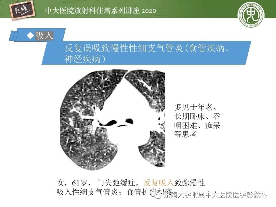 影像PPT - 【PPT】肺内常见影像征象解读 （树芽征、指套征）-26