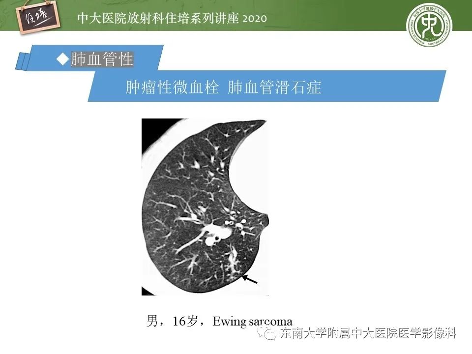 影像PPT - 【PPT】肺内常见影像征象解读 （树芽征、指套征）-31
