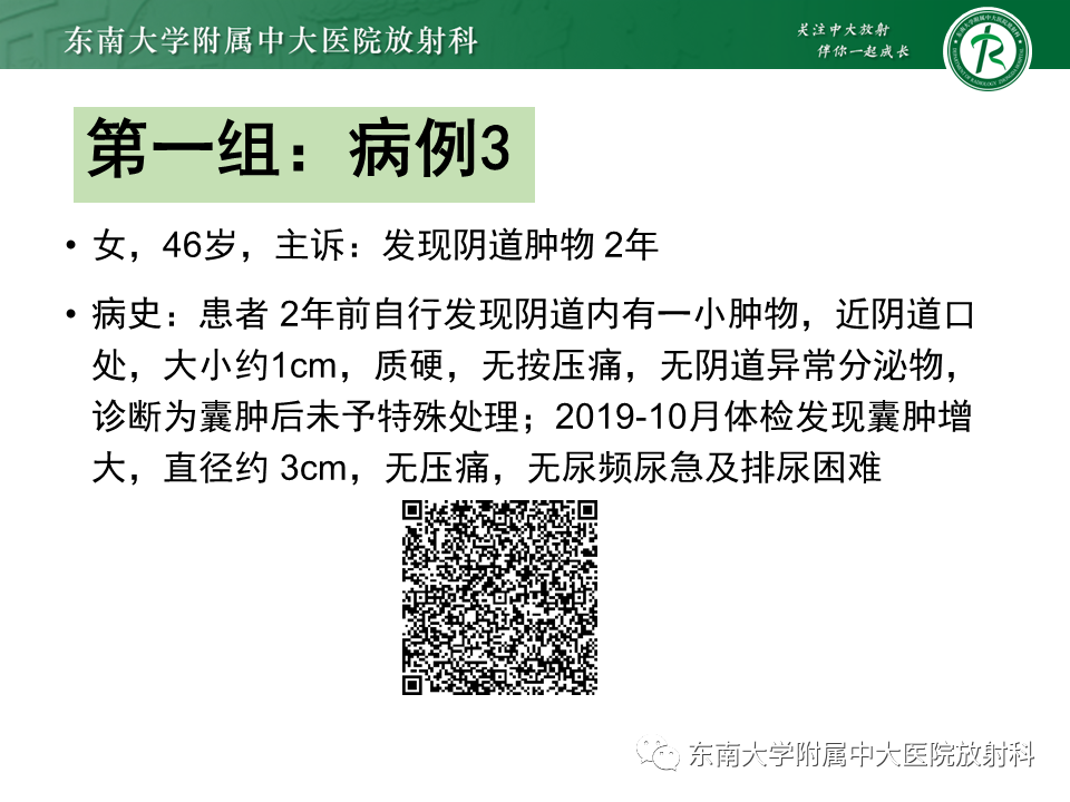 影像PPT - 【PPT】女性尿道生殖膈区占位性病变—阴道恶性肿瘤-9