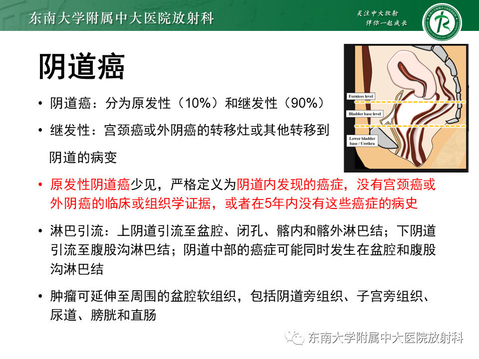 影像PPT - 【PPT】女性尿道生殖膈区占位性病变—阴道恶性肿瘤-36