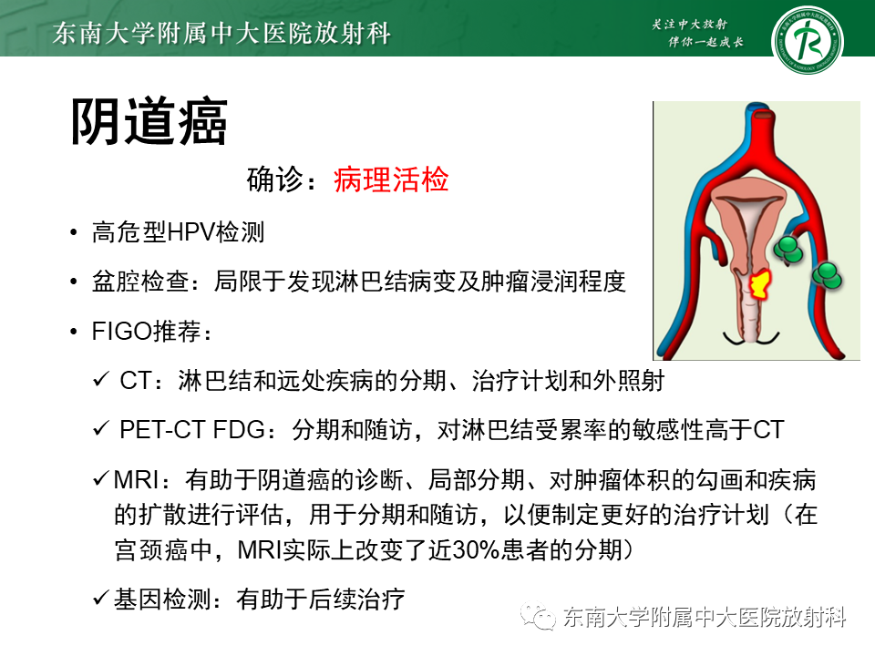 影像PPT - 【PPT】女性尿道生殖膈区占位性病变—阴道恶性肿瘤-39