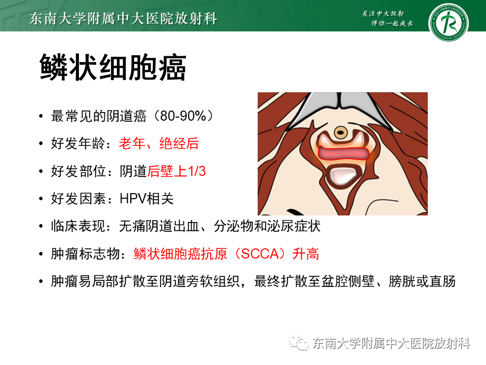 影像PPT - 【PPT】女性尿道生殖膈区占位性病变—阴道恶性肿瘤-48