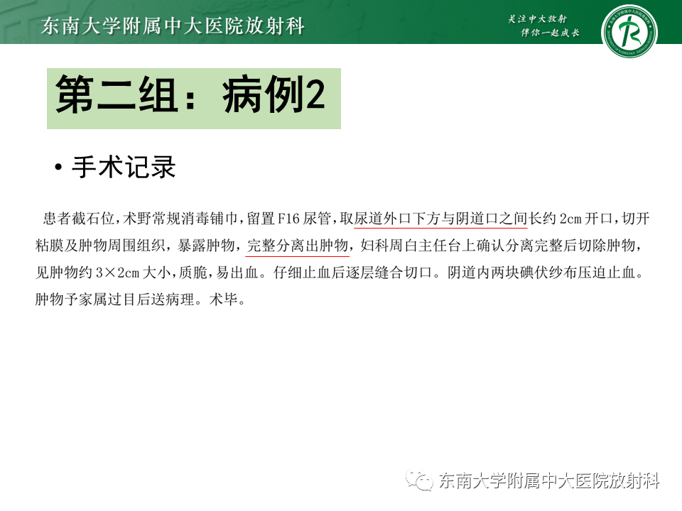 影像PPT - 【PPT】女性尿道生殖膈区占位性病变—阴道恶性肿瘤-4