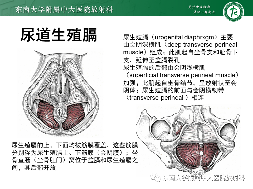 影像PPT - 【PPT】女性尿道生殖膈区占位性病变—阴道恶性肿瘤-5