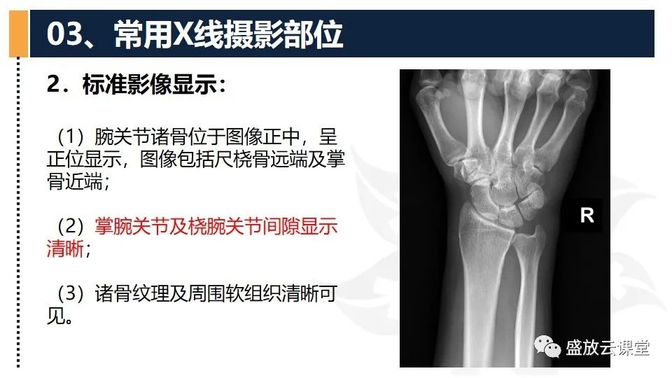 影像PPT - 【PPT】数字X线摄影检查（三）-4
