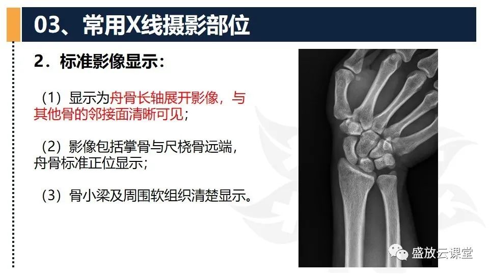 影像PPT - 【PPT】数字X线摄影检查（三）-8