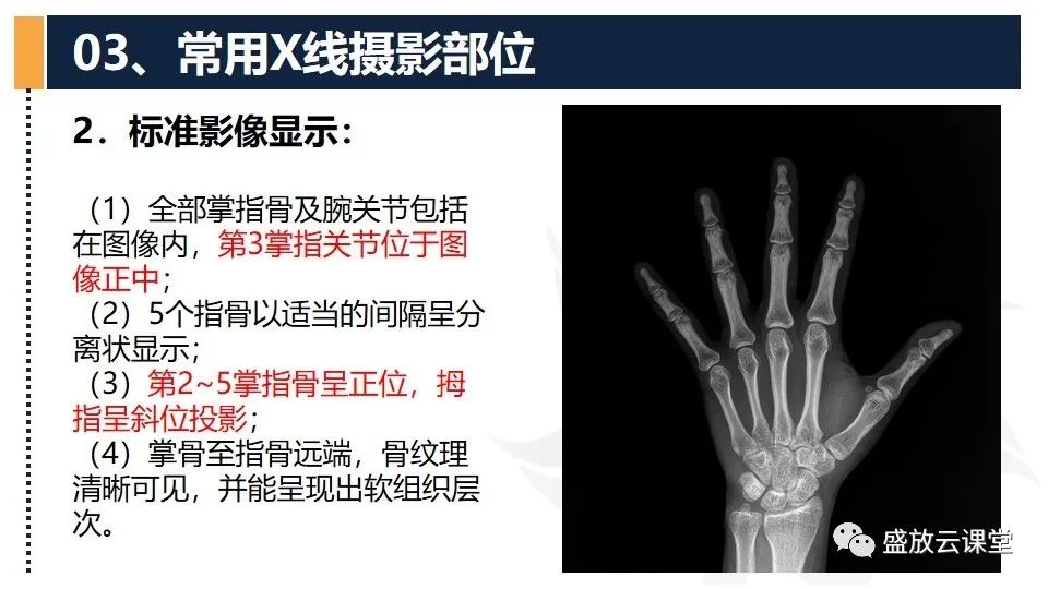 影像PPT - 【PPT】数字X线摄影检查（三）-10