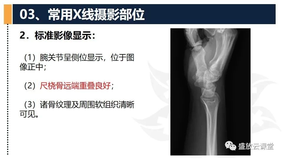 影像PPT - 【PPT】数字X线摄影检查（三）-6