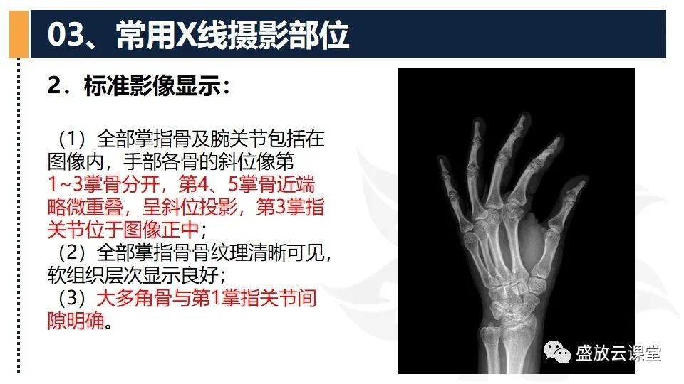 影像PPT - 【PPT】数字X线摄影检查（三）-12