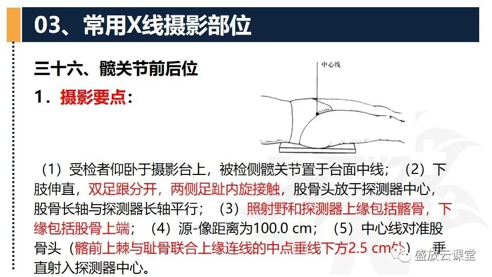 影像PPT - 【PPT】数字X线摄影检查（三）-13