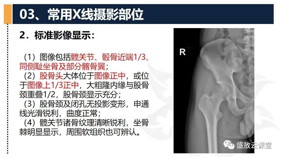 影像PPT - 【PPT】数字X线摄影检查（三）-14