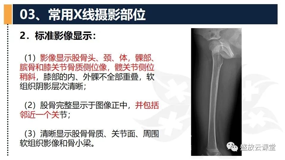 影像PPT - 【PPT】数字X线摄影检查（三）-18