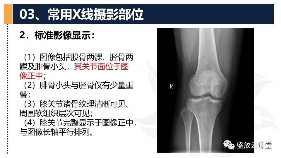 影像PPT - 【PPT】数字X线摄影检查（三）-20
