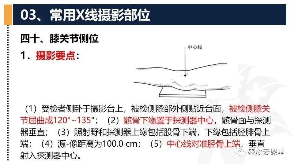 影像PPT - 【PPT】数字X线摄影检查（三）-21