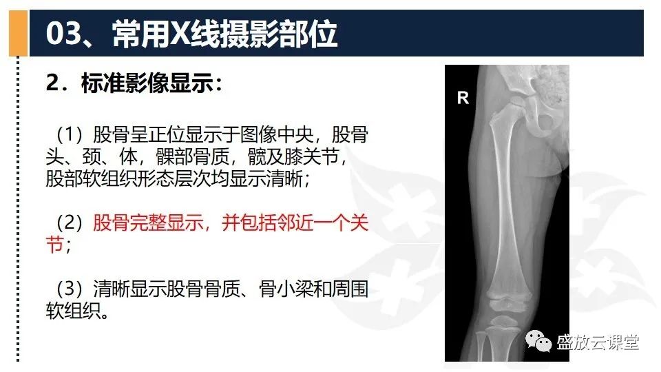 影像PPT - 【PPT】数字X线摄影检查（三）-16