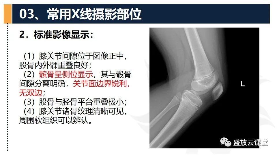 影像PPT - 【PPT】数字X线摄影检查（三）-22