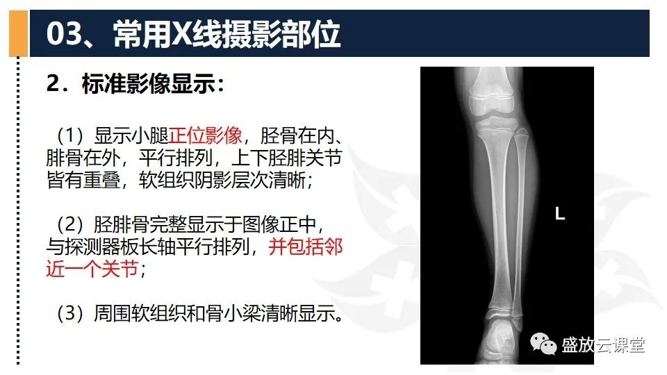 影像PPT - 【PPT】数字X线摄影检查（三）-24