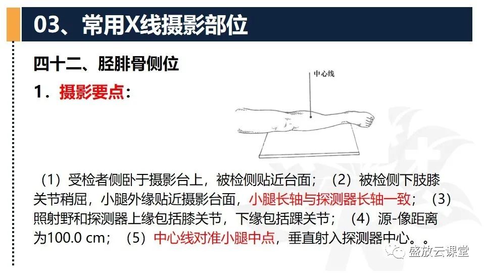 影像PPT - 【PPT】数字X线摄影检查（三）-25