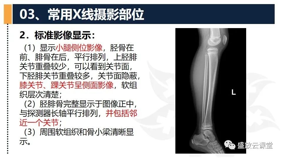 影像PPT - 【PPT】数字X线摄影检查（三）-26