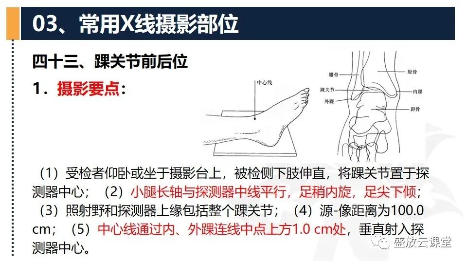 影像PPT - 【PPT】数字X线摄影检查（三）-27