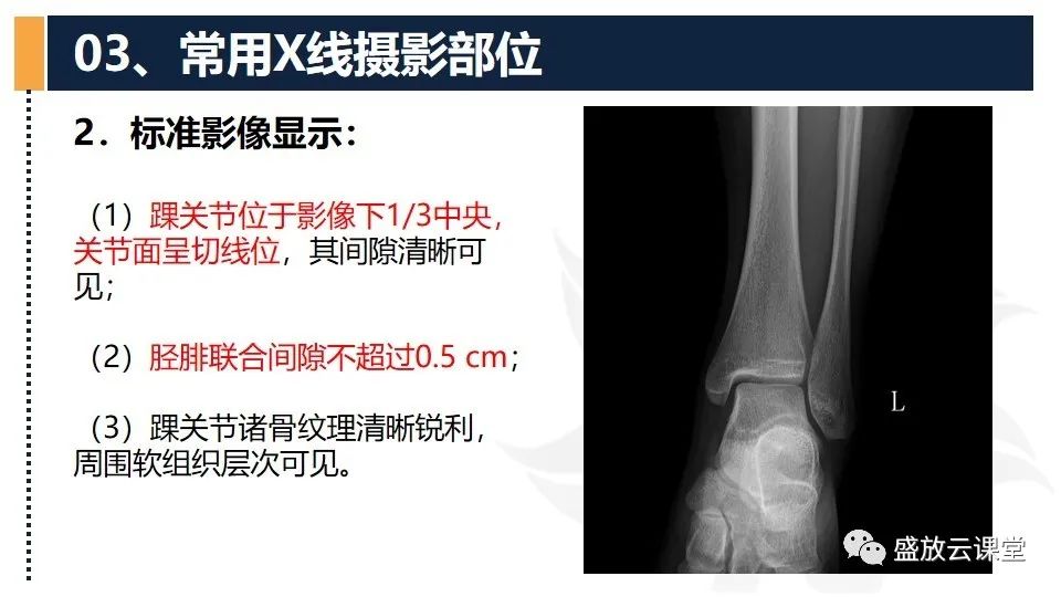 影像PPT - 【PPT】数字X线摄影检查（三）-28