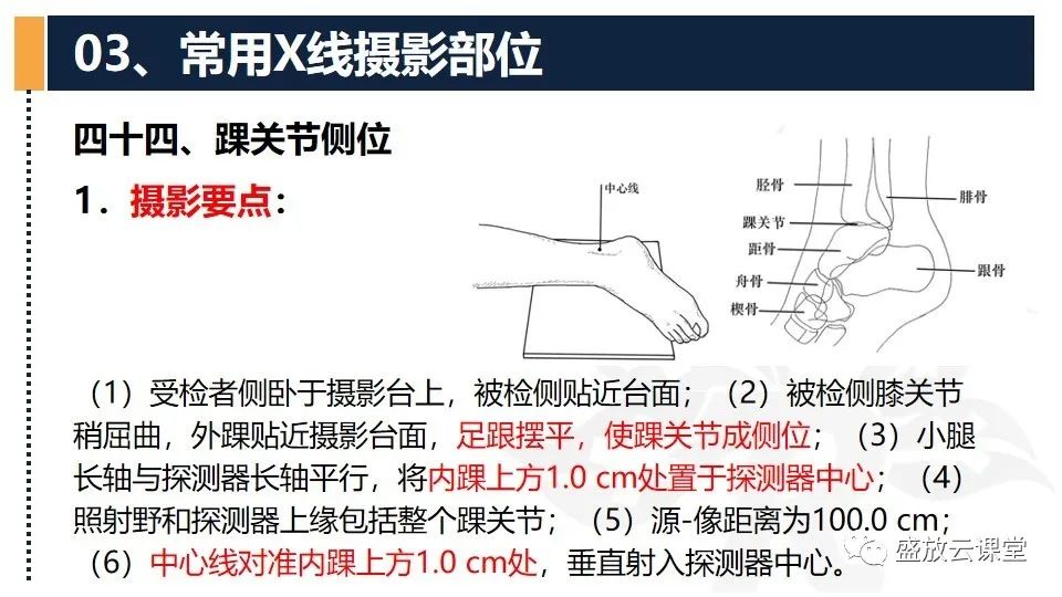 影像PPT - 【PPT】数字X线摄影检查（三）-29