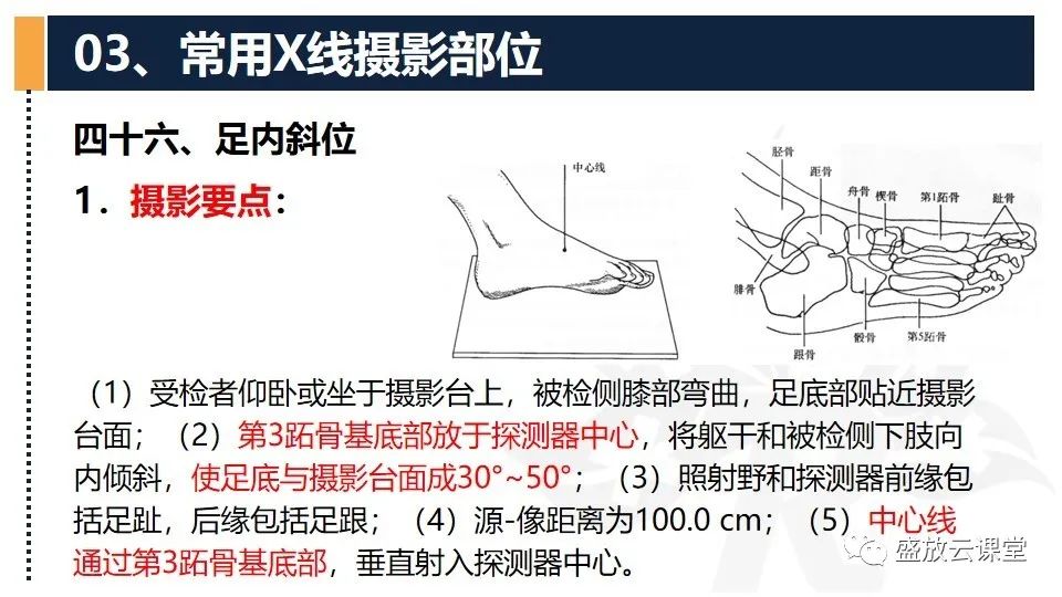 影像PPT - 【PPT】数字X线摄影检查（三）-33