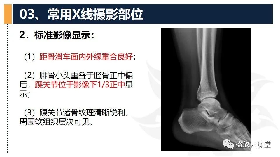 影像PPT - 【PPT】数字X线摄影检查（三）-30