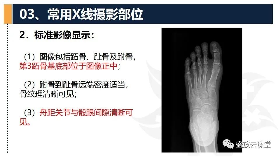 影像PPT - 【PPT】数字X线摄影检查（三）-32