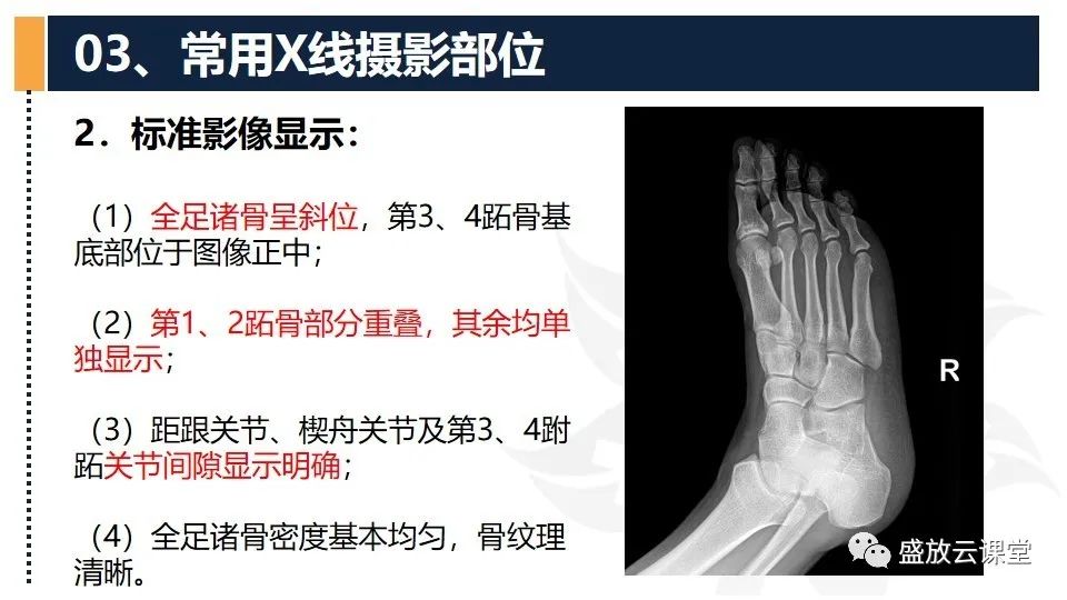 影像PPT - 【PPT】数字X线摄影检查（三）-34