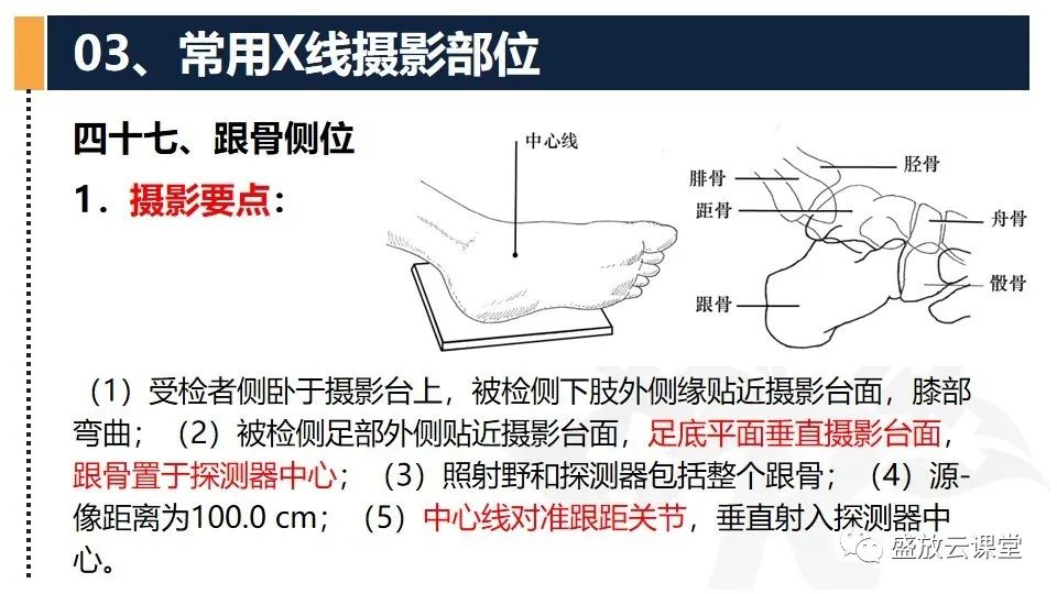 影像PPT - 【PPT】数字X线摄影检查（三）-35