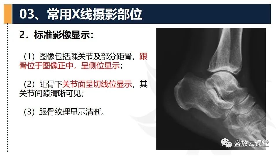 影像PPT - 【PPT】数字X线摄影检查（三）-36