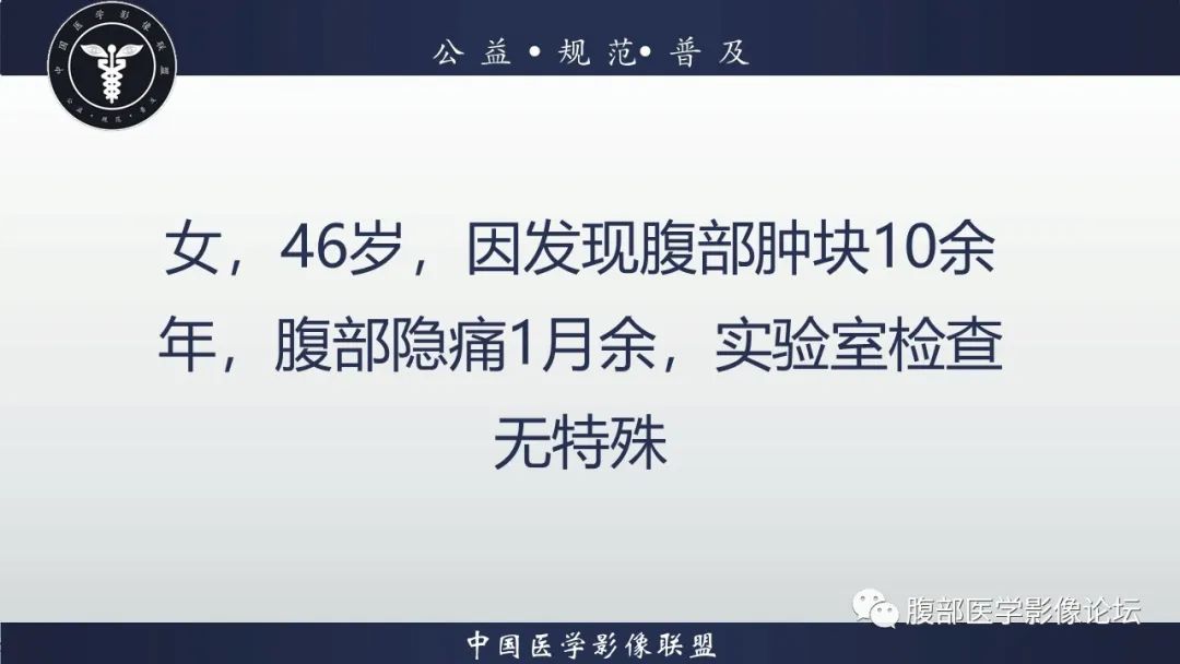 影像PPT - 【病例】腹腔后神经鞘瘤1例CT-2 影像PPT - 【病例】腹腔后神经鞘瘤1例CT-2