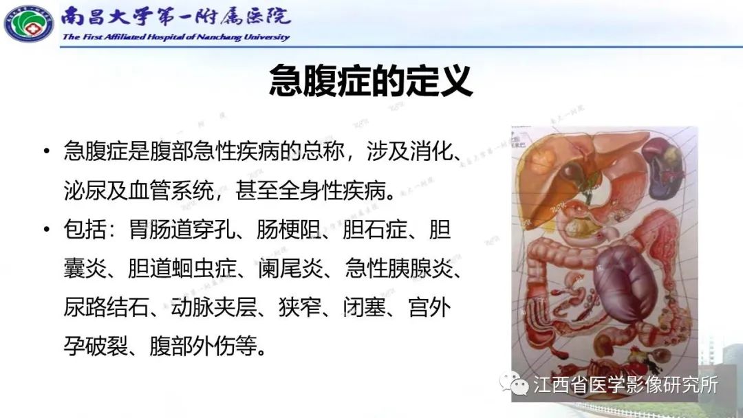 影像PPT - 【PPT】消化道急腹症的CT诊断-3