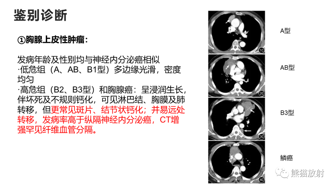 影像PPT - 【病例】纵隔神经内分泌癌 VS 胸腺鳞癌-37