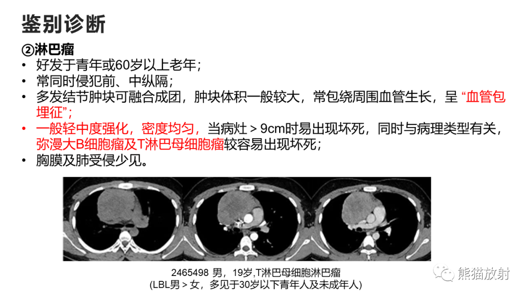 影像PPT - 【病例】纵隔神经内分泌癌 VS 胸腺鳞癌-38