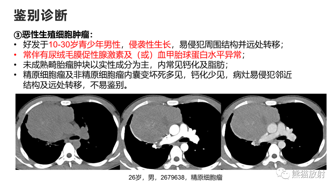 影像PPT - 【病例】纵隔神经内分泌癌 VS 胸腺鳞癌-39
