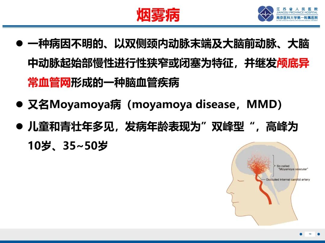 影像PPT - 【PPT】烟雾病和烟雾综合征血管重建术后影像评估-15