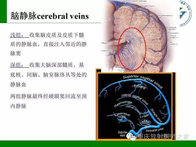 影像PPT - 【PPT】脑静脉解剖及相关疾病影像学诊断-4