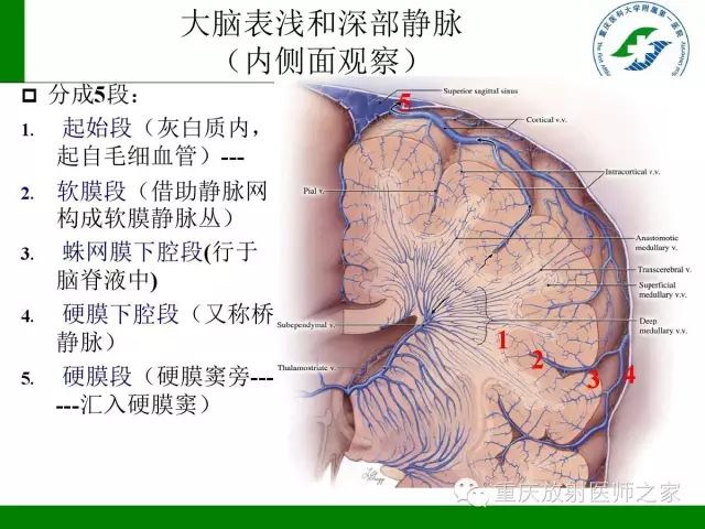 影像PPT - 【PPT】脑静脉解剖及相关疾病影像学诊断-5