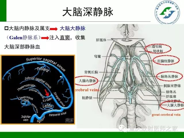 影像PPT - 【PPT】脑静脉解剖及相关疾病影像学诊断-9