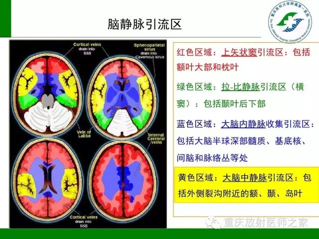 影像PPT - 【PPT】脑静脉解剖及相关疾病影像学诊断-11