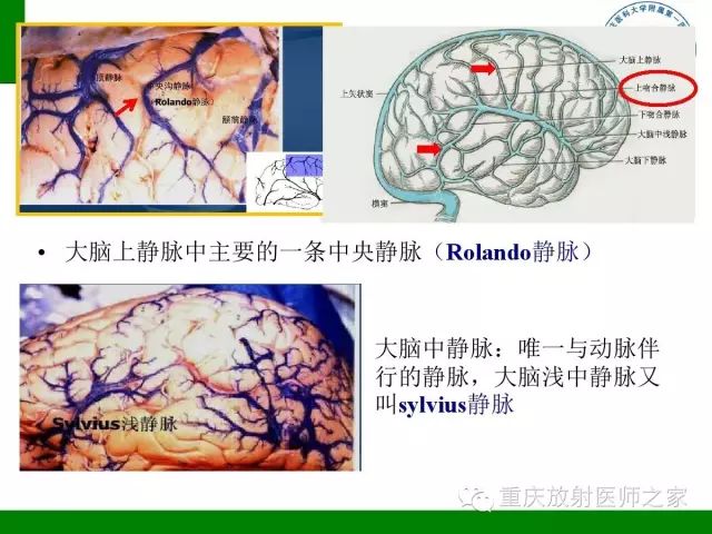 影像PPT - 【PPT】脑静脉解剖及相关疾病影像学诊断-7