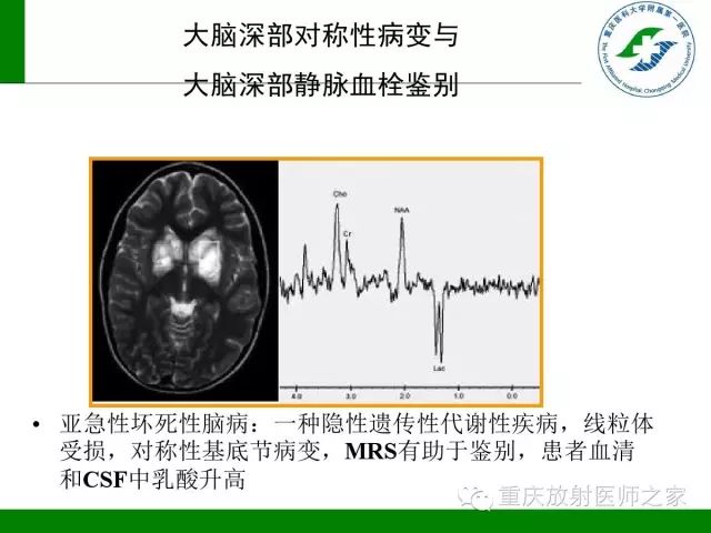 影像PPT - 【PPT】脑静脉解剖及相关疾病影像学诊断-63