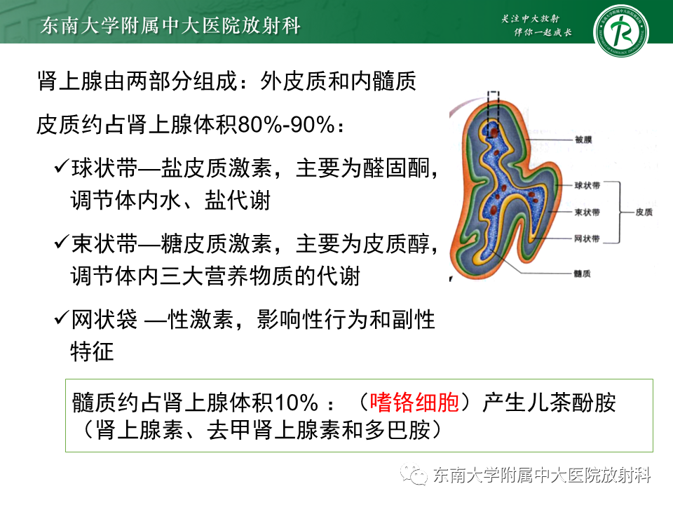 影像PPT - 【PPT】肾上腺嗜铬细胞瘤的影像诊断-5 影像PPT - 【PPT】肾上腺嗜铬细胞瘤的影像诊断-5