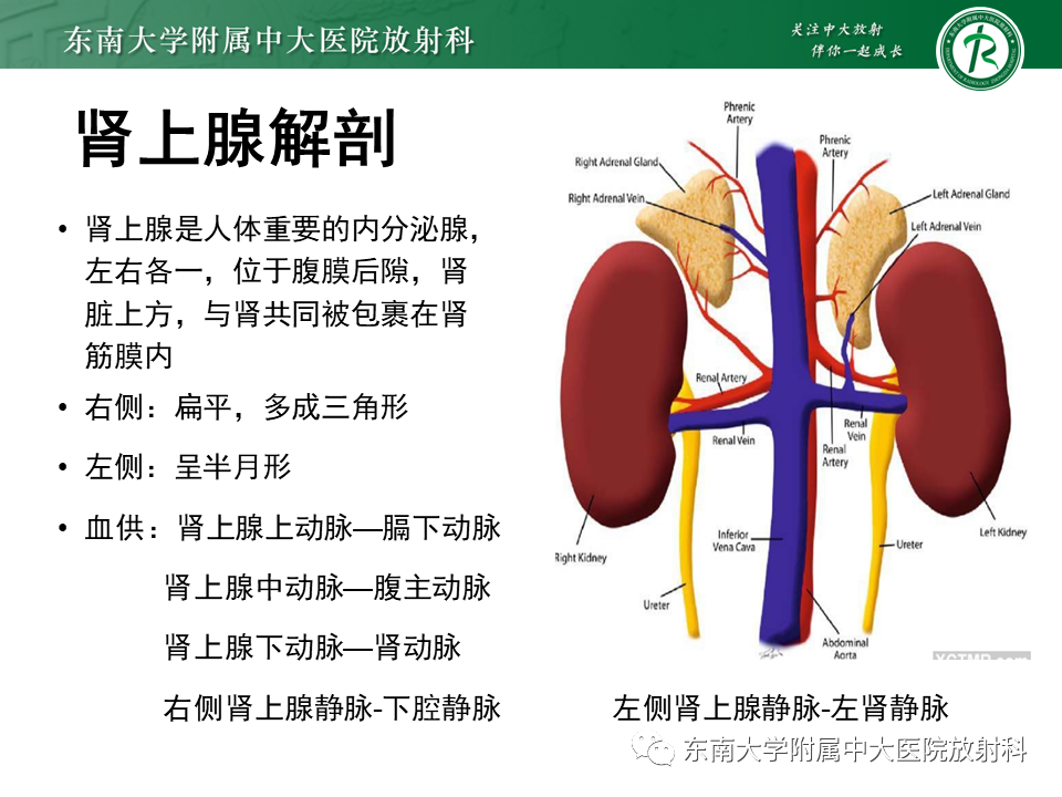 影像PPT - 【PPT】肾上腺嗜铬细胞瘤的影像诊断-4 影像PPT - 【PPT】肾上腺嗜铬细胞瘤的影像诊断-4
