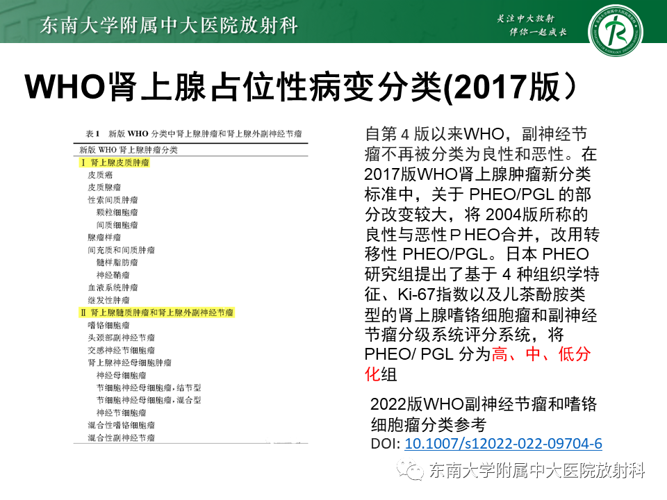 影像PPT - 【PPT】肾上腺嗜铬细胞瘤的影像诊断-7 影像PPT - 【PPT】肾上腺嗜铬细胞瘤的影像诊断-7
