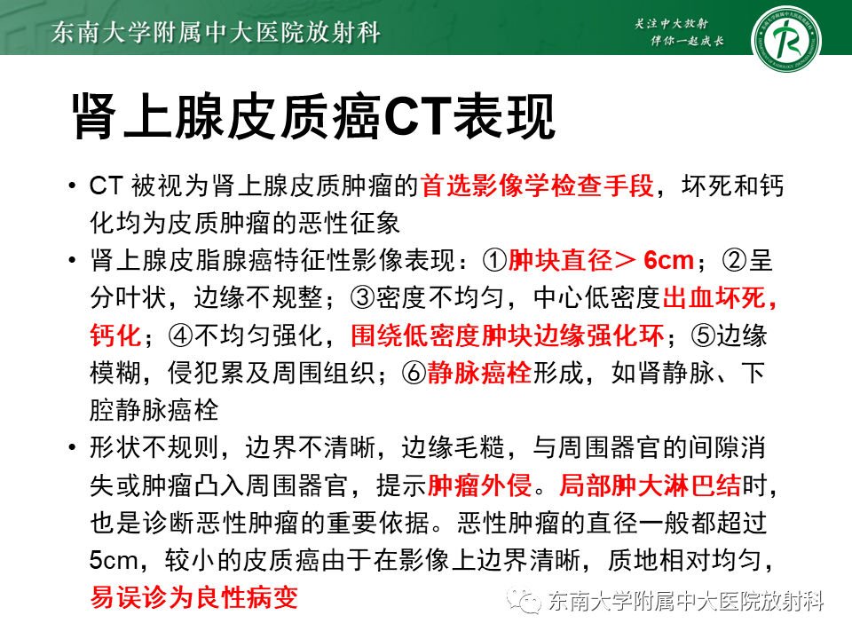 影像PPT - 【PPT】肾上腺嗜铬细胞瘤的影像诊断-22 影像PPT - 【PPT】肾上腺嗜铬细胞瘤的影像诊断-22